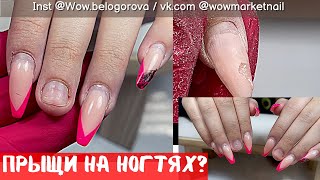 Прыщи на ногтях😱| Не досушили гель, что делать? Ходила так целый месяц! Коррекция| Наращивание