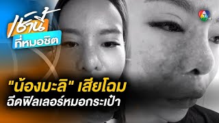 หวิดตาบอด ! สาวฉีดฟิลเลอร์หมอกระเป๋า สุดท้ายหน้าพัง ไร้การรับผิดชอบ