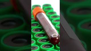 The Shocking Truths of HIV: Exposing the Hidden Reality