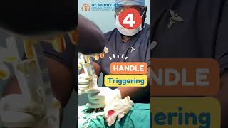 5 Steps of Stapler Circumcision