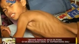 24Oras: Batang nahulog mula sa puno, 'di na makalakad dahil sa napabayaang bali