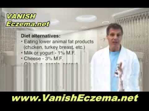 Supplements Which Can Help You Treat Eczema Supplements Which Can Help You Treat Eczema