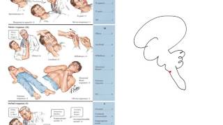 Principles of the glasgow coma scale