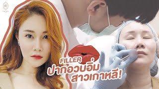 รีวิวฉีดฟิลเลอร์ปากอวบอิ่ม เทรนสุดฮิต!!