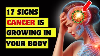 Don't Miss These 17 Early Cancer Signs – It Could Save You! (Part 1)