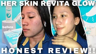 #herskinrevitaglow HER SKIN: REVITA GLOW SKIN RESCUE HONEST REVIEW!! (With 7days result)| Shiela V.