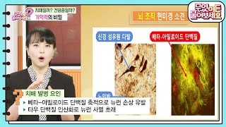 [백년습관] 뇌 훈련으로 강화되는 기억력, 치매의 발병 요인까지 알아보자! [무엇이든 물어보세요] | KBS 240814 방송