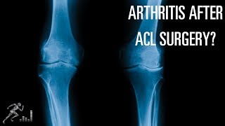 What is the risk of arthritis after an ACL injury?
