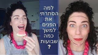 למה מסגרת הפנים שלי הפכה לשחורה?