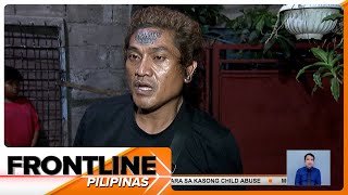 Lalaking nagpa-tattoo sa noo kapalit ang P100,000, nilinaw na hindi gimik ang sinalihang contest