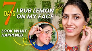 skin whitening challenge in 7 days | 7 day Lemon Challenge for Skin Care | i Ruin My skin