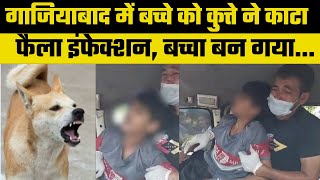 Ghaziabad: 14 Year old Ghaziabad boy dies of rabies, month after dog bite, कुत्ते ने काटा, मौत