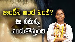 What are the main causes of Jaundice / జాండీస్ అంటే ఏంటి? ఈ సమస్య ఎందుకొస్తుంది.||Samayam Telugu