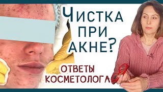 146| Чистка лица - добро или зло? Кому нужна? При акне. Куда идти? отвечаю на ваши вопросы