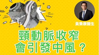 腦健康速報03：頸動脈收窄會形成中風？