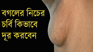 Axillary Fat Pad/Armpit Fat কিভাবে দূর করবেন ? বগলের নিচের চর্বি দূর করার উপায় ?