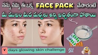 ఈ ఒక్క పాక్ తో మీ ముఖం మీద మచ్చలు అన్ని పోతాయి🤩||best face pack for glowing skin #nenunaillu