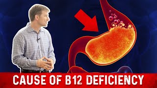 Vitamin B12 Deficiency: The most common Cause – Dr. Berg
