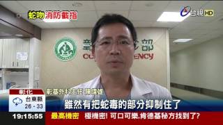 消防員抓毒蛇被咬左手食指慘截指2節