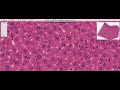 histology of the liver sinusoidal lining cells