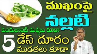 FACE పై నల్లటి పెంకు లాంటి మచ్చలు కూడా 5 డేస్ లో దూరం | Dr Manthena Satyanarayana Raju Videos