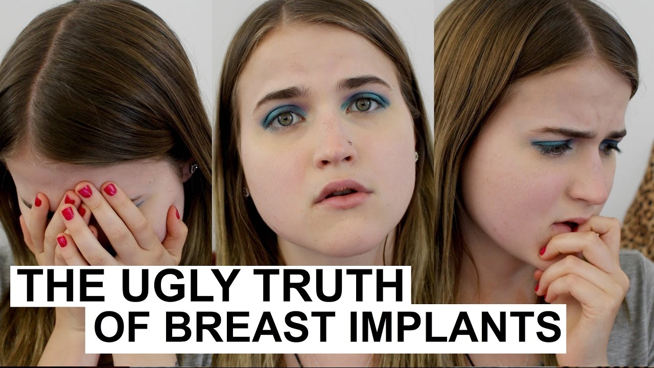 BREAST IMPLANT ILLNESS IS REAL! - YouTube