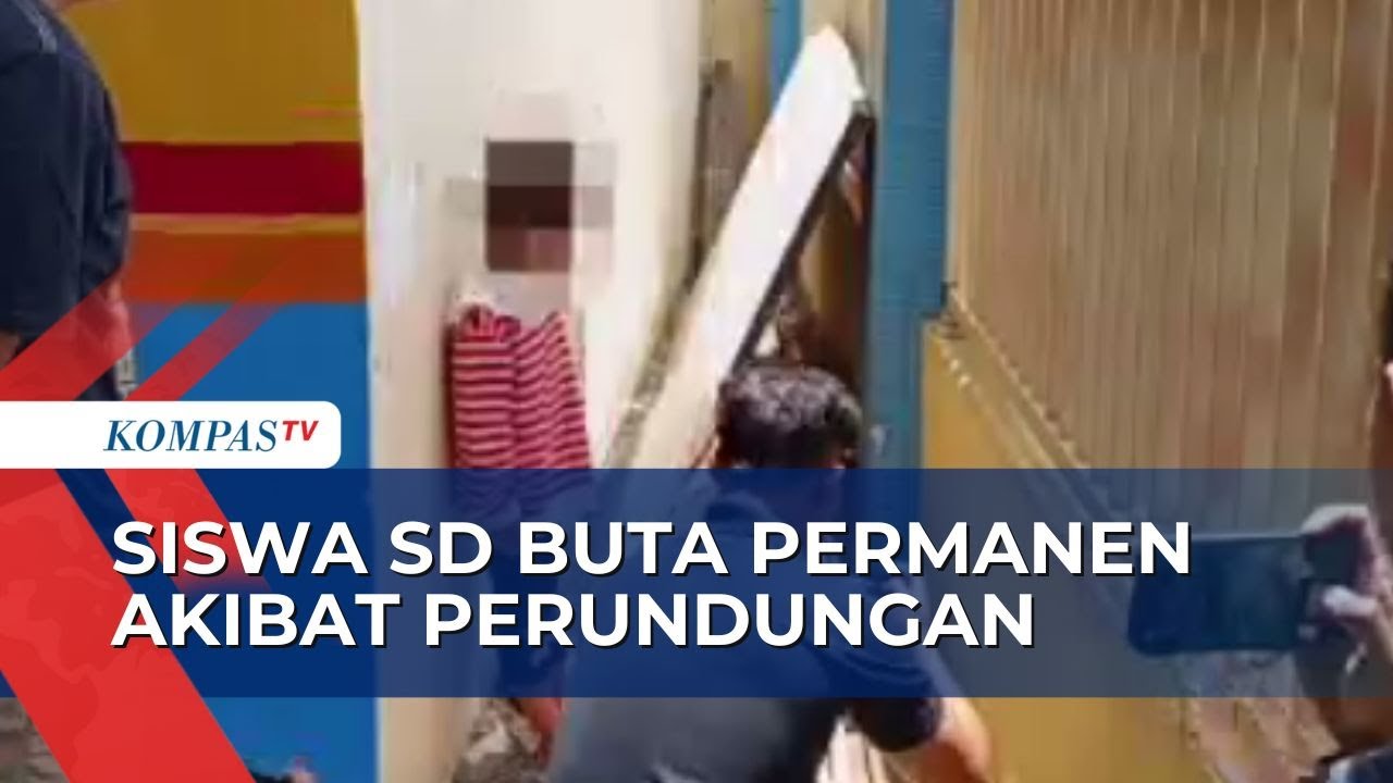 Jadi Korban Bully, Siswa SD Di Gresik Buta Permanen Akibat Dilukai ...