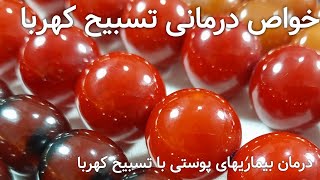 خواص درمانی #تسبیح کهربای اصل