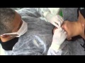 Ronaldo Sampaio Snoopy Piercing using Hooked Precision Needles - PainfulPleasures.com