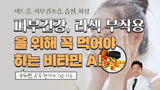 잔주름이 생기는 이유는 비타민A 결핍?