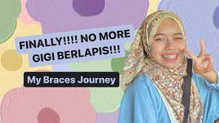 #6 Gigi berlapis who???? | My braces journey