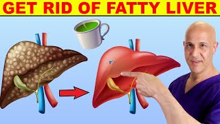 2 Cups a Day...Cleans Up FATTY LIVER | Dr. Mandell