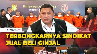 Polisi Ungkap Kronologi Terbongkarnya Sindikat Jual Beli Ginjal Internasional