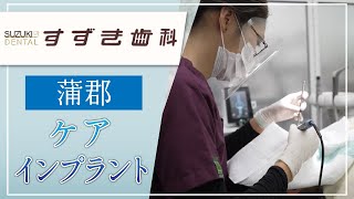 蒲郡でインプラントのケアは評判のすずき歯科