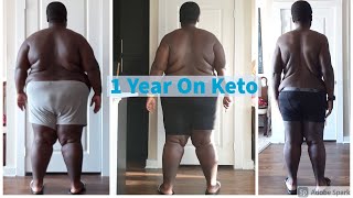 1 Year In Ketosis, 200lbs/90kg Lost | Results of 1 Year of Keto Diet and Fasting