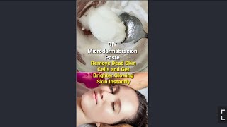 #Shorts ఇంట్లోనే స్పా ట్రీట్మెంట్ | Microdermabrasion Paste | Spa Treatment At Home #YoutubeShorts