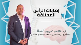 إصابات الرأس