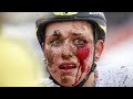 MTB FAILS #25 - Ultimate Compilation of the BEST #MTB CRASHES 2022