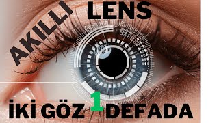 AKILI LENS BİR GÜNDE  İKİ GÖZ BİRDEN TOPLAM 20 DAKİKALIK OPERASYON SÜRDÜ.(Triptokal Lens)