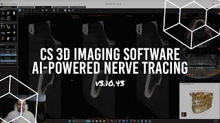 Carestream Dental CBCT - AI-powered Nerve Tracing in v3.10.43