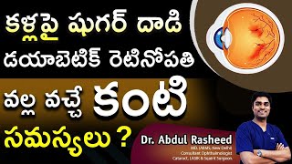 Sugar patient eye problems telugu I డయాబెటిక్ రెటినోపతి వల్ల వచ్చే కంటి సమస్యలు I  Dr Abdul Rasheed