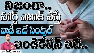 నిజంగా ..హార్ట్ ఎటాక్ వస్తే బాడీ ఇచ్చే సింపుల్ ఇండికేషన్ ఇదే | Dr. MadhuBabu | Health Trends |