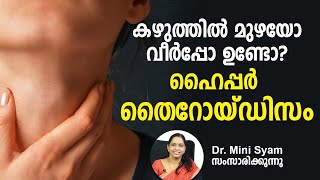 കഴുത്തിൽ മുഴയോ വീർപ്പോ ഉണ്ടോ  ഹൈപ്പർ തൈറോയ്ഡിസം| Hyperthyroidism   Goiter  | Asia Live TV Health