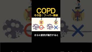 COPDってなに⑧〜フーバー徴候って知ってる？〜#作業療法士 #呼吸 #理学療法士 #看護師 #呼吸器