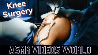 Asmr Surgery | Knee Surgery | Full Surgery Best Video Animation