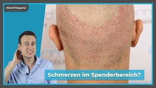 Schmerzen nach Haartransplantation | Heilungsverlauf \u0026 Empfindlichkeit des Spenderbereichs