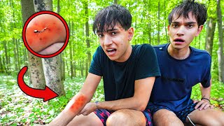 I Got ATTACKED By Fire Ants!