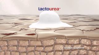 SPOT LACTOVIT LACTOUREA 2017