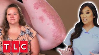 Dr Lee Treats A Woman With Three Different Skin Conditions | Dr Pimple Popper: Pop-Ups