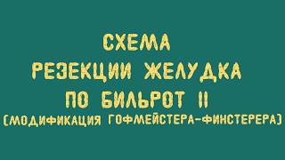 Схема резекции желудка по Бильрот II (модификация Гофмейстера-Финстерера)